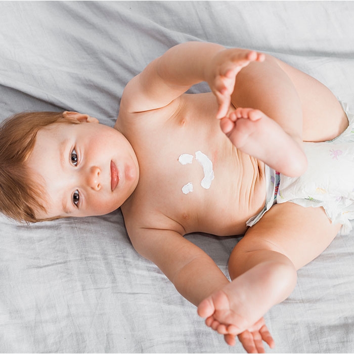 Συγκαμάτα στο μωρό: τι να προσέξεις και τι βοηθά